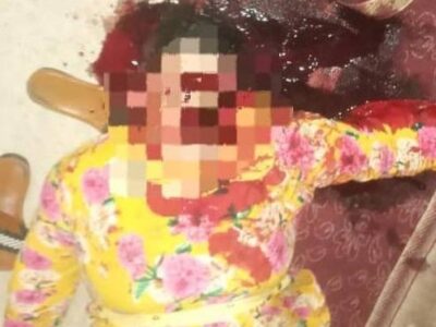 Unknown Gunmen Shoot A Woman in Jawzjan Province