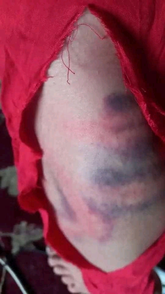 The Taliban rape a female civil activist in Badghis