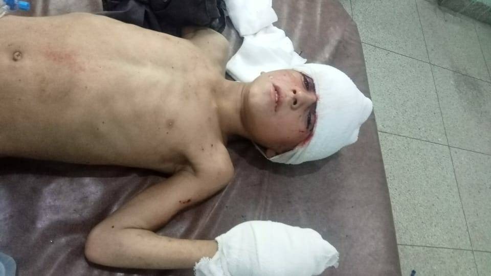کندهار کې د یوې سرګلولې چاودنې له امله د یو طالب په ګډون څلور تنه ټپیان شوي