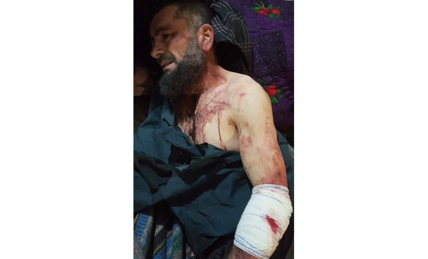 کشته شدن یک مرد در فاریاب