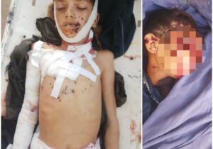 ننګرهار کې د ناوده مرمۍ چاودنې له امله ۳ ماشومانو ته مرګ ژوبله اوښتې