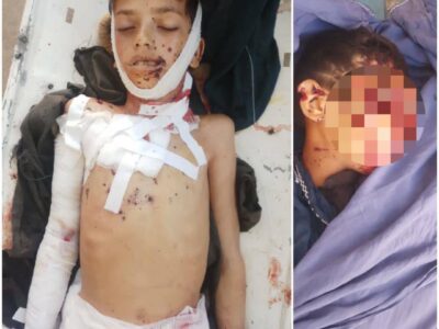 ننګرهار کې د ناوده مرمۍ چاودنې له امله ۳ ماشومانو ته مرګ ژوبله اوښتې
