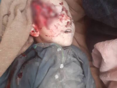انفجار یک سر گلوله بمب افگن در ولایت سرپل جان یک کودک پنج ساله را گرفت