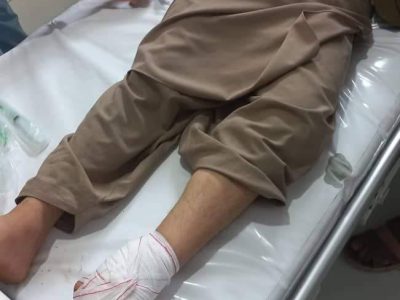 وقوع یک انفجار در سرپل ۷ مجروح به جا گذاشت