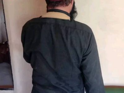 یک مرد در غزنی به اثر پاشیدن تیزاب چشمان خانمش را کور کرد