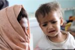 یونیسف: امسال۳۴۳ هزار کودک مبتلا به سوء تغذیه افغان را بستری کردیم